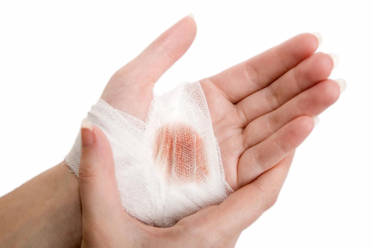 ما تأويلات ابن سيرين عن الخدوش في المنام؟