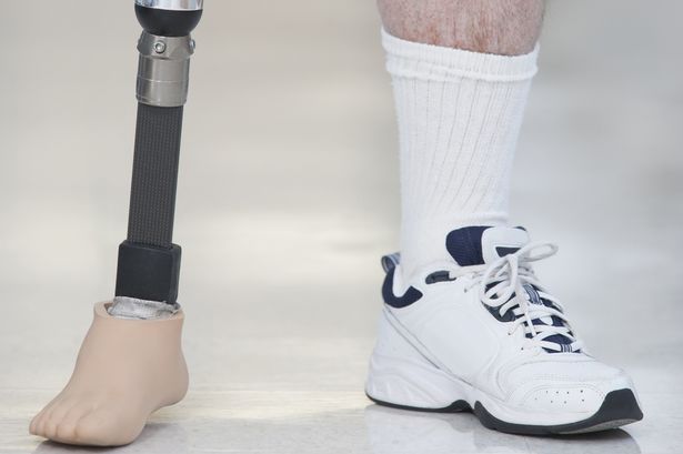 ما تفسير الحلم ببتر الرجل لابن سيرين؟