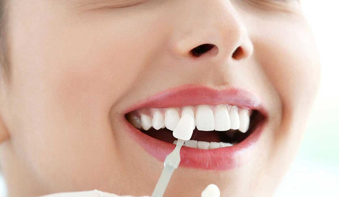 ما تفسير الحلم بسقوط حشوة الاسنان لابن سيرين؟