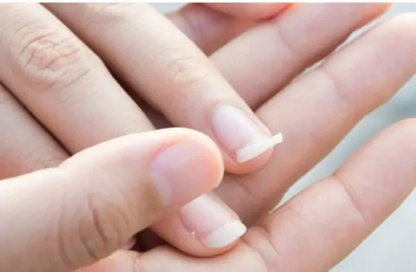 ما تأويلات رؤية الظفر في المنام لابن سيرين؟