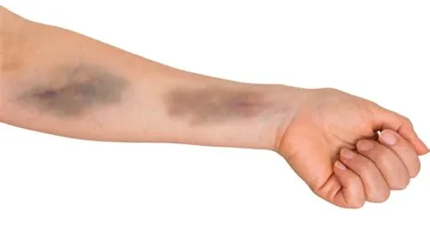 ماهو تفسير رؤية اليد الزرقاء في المنام لابن سيرين؟